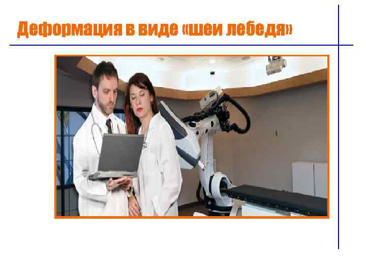 Деформация в виде «шеи лебедя» 