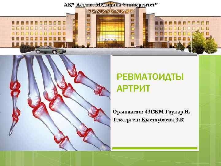 АҚ” Астана Медицина Университет” РЕВМАТОИДТЫ АРТРИТ Орындаған: 431 ЖМ Гаукар Н. Тексерген: Қыстаубаева З.