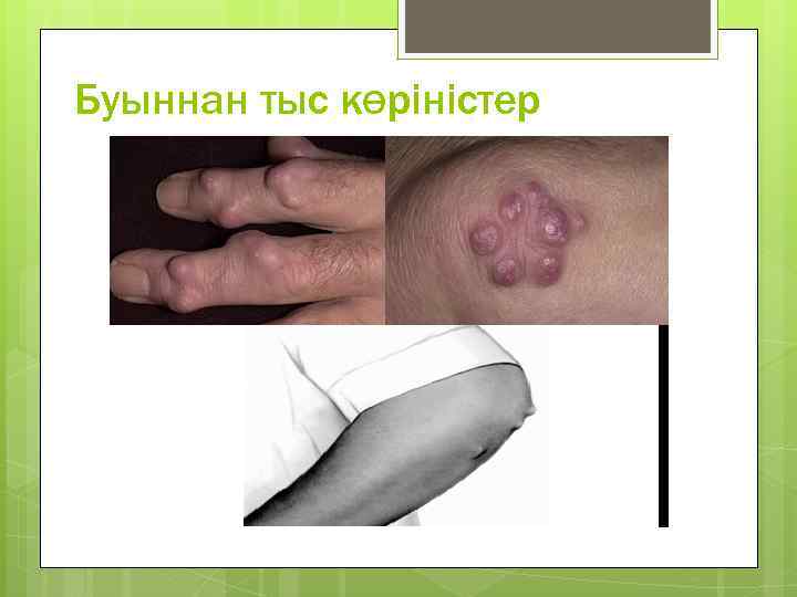 Буыннан тыс көріністер 