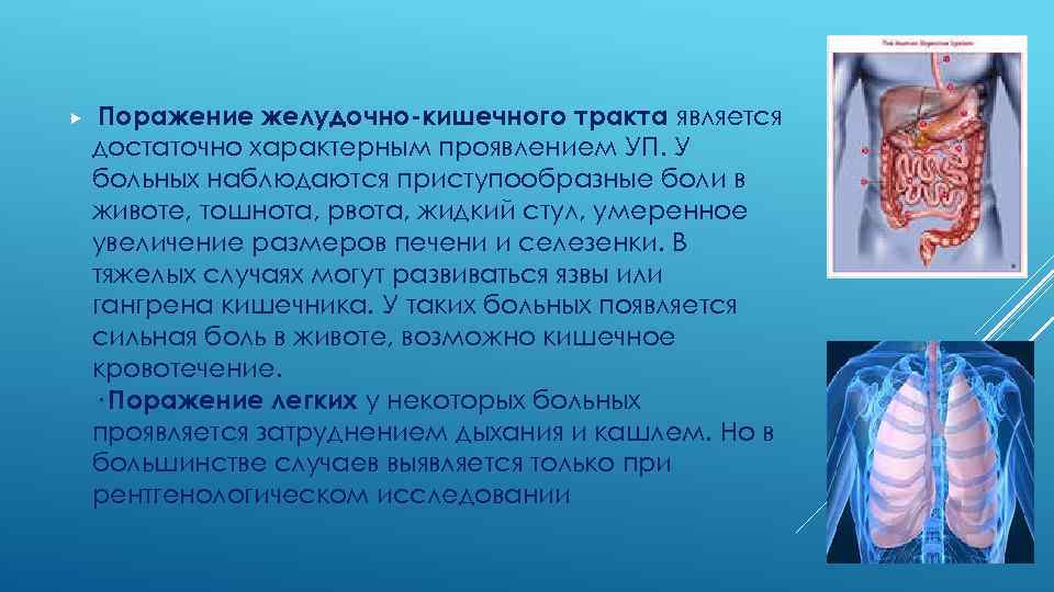  Поражение желудочно-кишечного тракта является достаточно характерным проявлением УП. У больных наблюдаются приступообразные боли