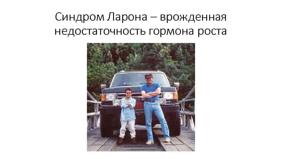 Синдром Ларона – врожденная недостаточность гормона роста 