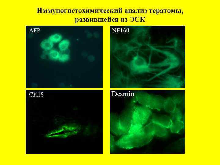 Иммуногистохимический анализ тератомы, развившейся из ЭСК AFP NF 160 CK 18 CK 1 Desmin