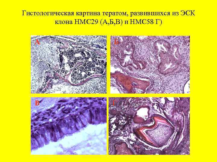 Гистологическая картина тератом, развившихся из ЭСК клона НМС 29 (А, Б, В) и НМС