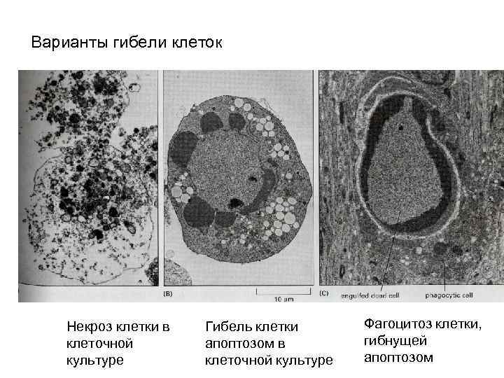 Варианты гибели клеток Некроз клетки в клеточной культуре Гибель клетки апоптозом в клеточной культуре