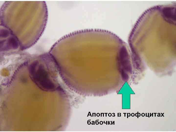Апоптоз в трофоцитах бабочки 