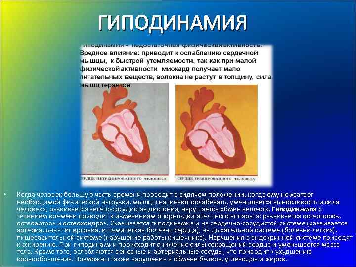 ГИПОДИНАМИЯ • Когда человек большую часть времени проводит в сидячем положении, когда ему не