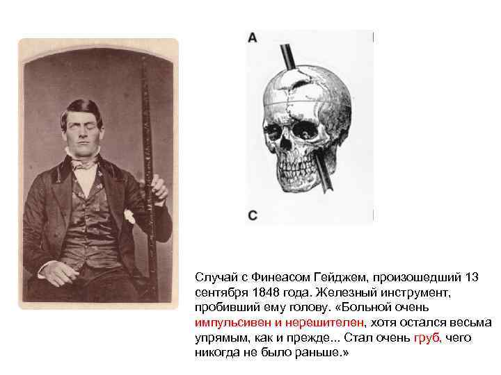 Случай с Финеасом Гейджем, произошедший 13 сентября 1848 года. Железный инструмент, пробивший ему голову.