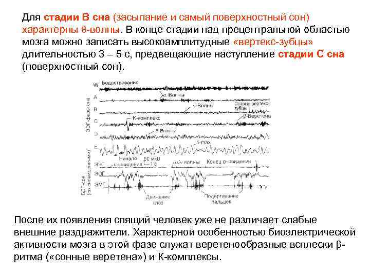Для стадии В сна (засыпание и самый поверхностный сон) характерны -волны. В конце стадии