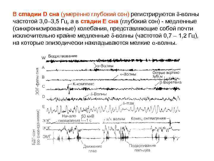 В cmадии D сна (умеренно глубокий сон) регистрируются -волны частотой 3, 0– 3, 5
