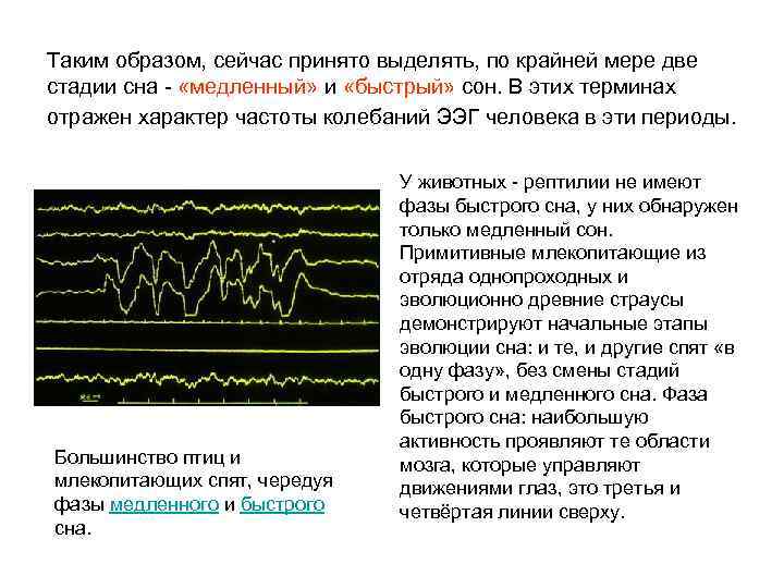 Таким образом, сейчас принято выделять, по крайней мере две стадии сна - «медленный» и