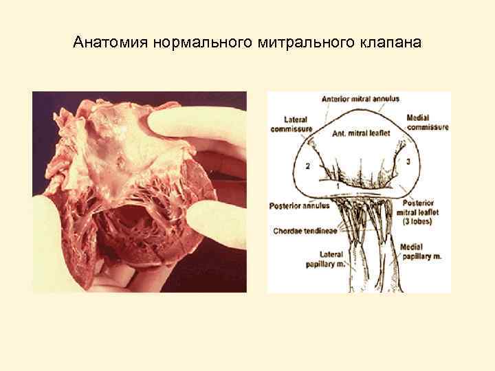 Анатомия нормального митрального клапана 