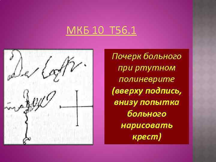 МКБ 10 T 56. 1 Почерк больного при ртутном полиневрите (вверху подпись, внизу попытка