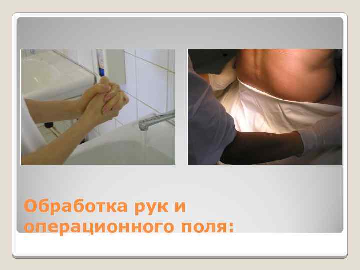 Обработка рук и операционного поля: 