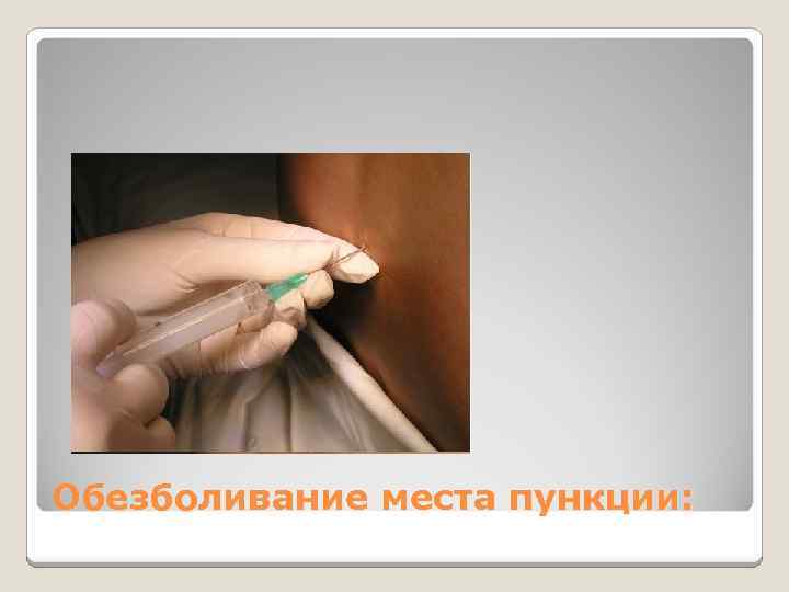 Обезболивание места пункции: 