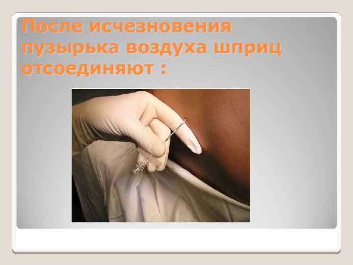 После исчезновения пузырька воздуха шприц отсоединяют : 