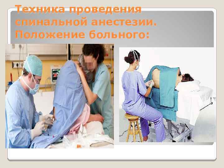 Техника проведения спинальной анестезии. Положение больного: 