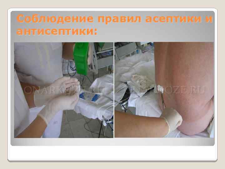 Соблюдение правил асептики и антисептики: 