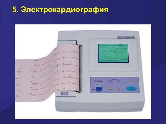 5. Электрокардиография 