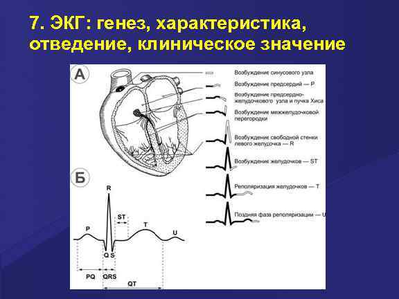 7. ЭКГ: генез, характеристика, отведение, клиническое значение 