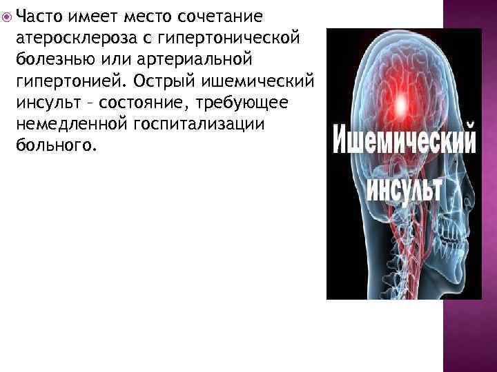  Часто имеет место сочетание атеросклероза с гипертонической болезнью или артериальной гипертонией. Острый ишемический