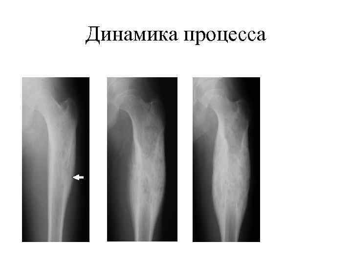 Динамика процесса 