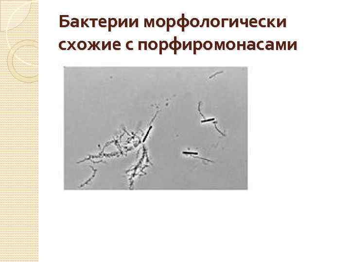 Бактерии морфологически схожие с порфиромонасами 