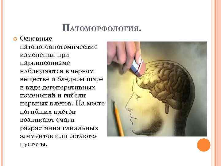 ПАТОМОРФОЛОГИЯ. Основные патологоанатомические изменения при паркинсонизме наблюдаются в черном веществе и бледном шаре в