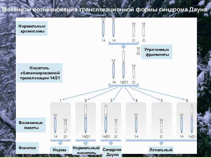 Механизм возникновения транслокационной формы синдрома Дауна Нормальные хромосомы Утраченные фрагменты Носитель сбалансированной транслокации 14/21