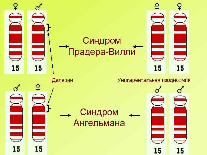 Синдром Прадера-Вилли Делеции Унипарентальная изодисомия Синдром Ангельмана 