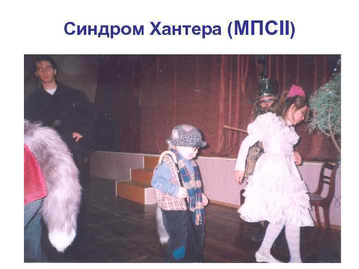 Синдром Хантера (МПСII) 