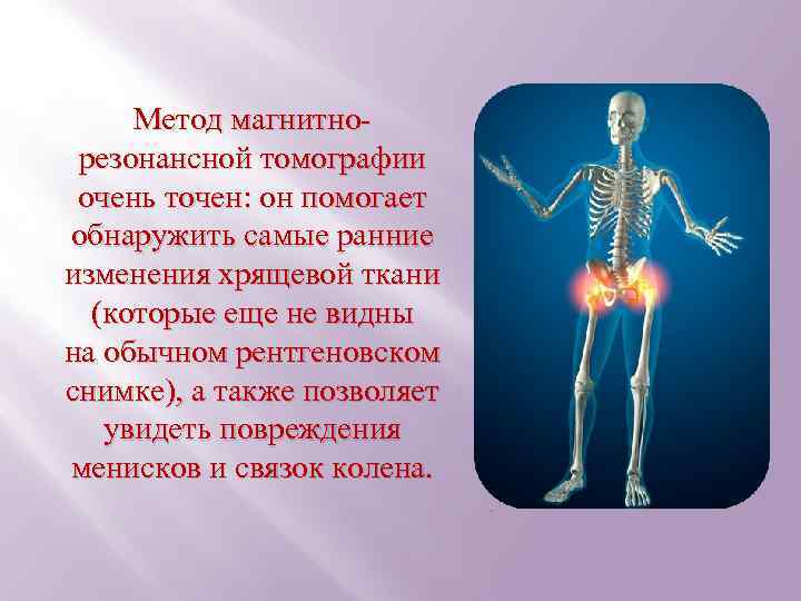 Метод магнитнорезонансной томографии очень точен: он помогает обнаружить самые ранние изменения хрящевой ткани (которые