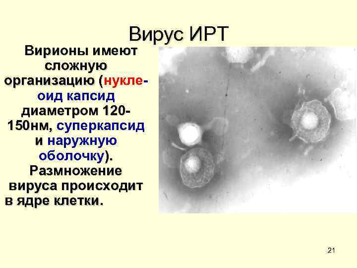 Вирус ИРТ Вирионы имеют сложную организацию (нукле( оид капсид диаметром 120150 нм, суперкапсид и