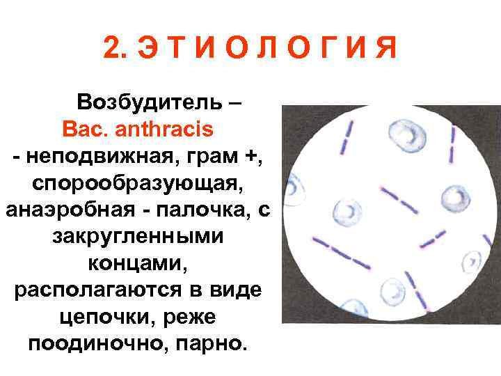 2. Э Т И О Л О Г И Я Возбудитель – Bac. anthracis