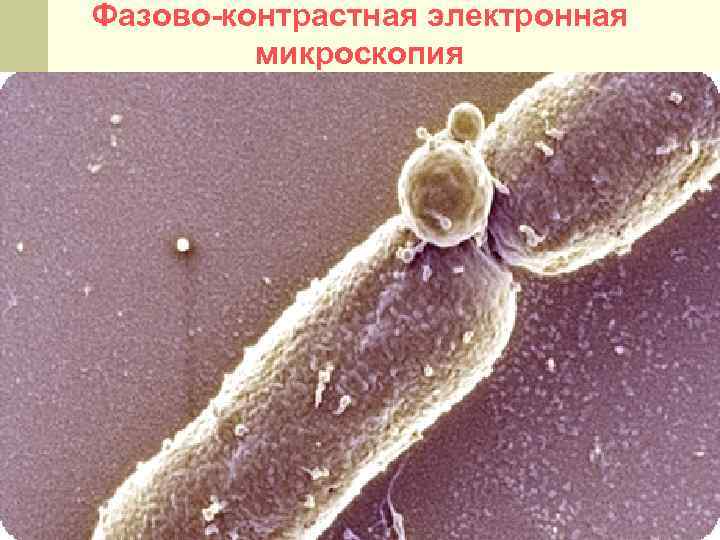 Фазово-контрастная электронная микроскопия 