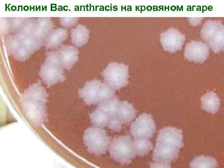 Колонии Bac. аnthracis на кровяном агаре 