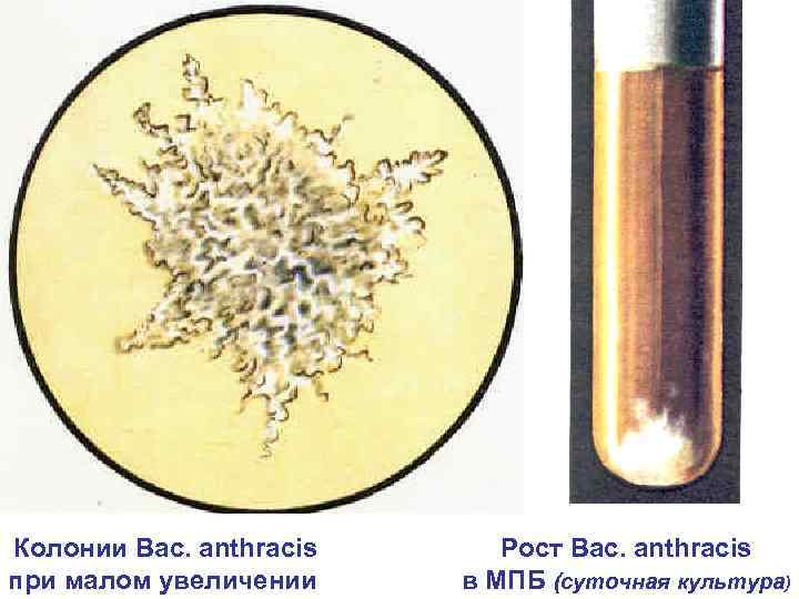 Колонии Bac. аnthracis при малом увеличении Рост Bac. аnthracis в МПБ (суточная культура) 