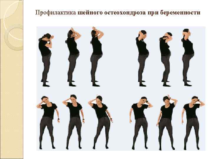 Профилактика шейного остеохондроза при беременности 