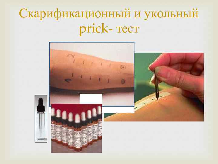Скарификационный и укольный prick- тест 