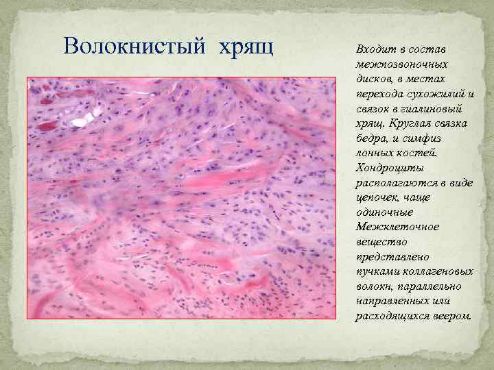 Волокнистый хрящ гистология рисунок