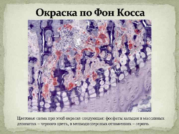 Окраска по Фон Косса Цветовая схема при этой окраске следующая: фосфаты кальция в массивных