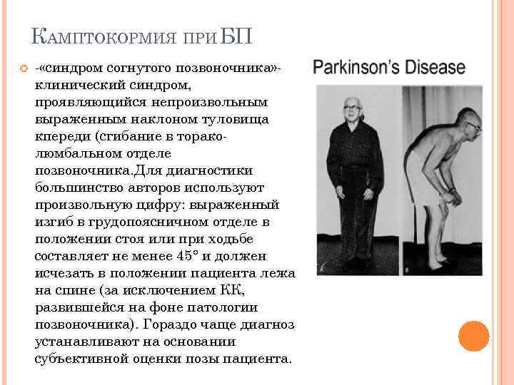 КАМПТОКОРМИЯ ПРИ БП «синдром согнутого позвоночника» клинический синдром, проявляющийся непроизвольным выраженным наклоном туловища кпереди