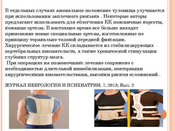 В отдельных случаях аномальное положение туловища улучшается при использовании заплечного рюкзака. Некоторые авторы предлагают