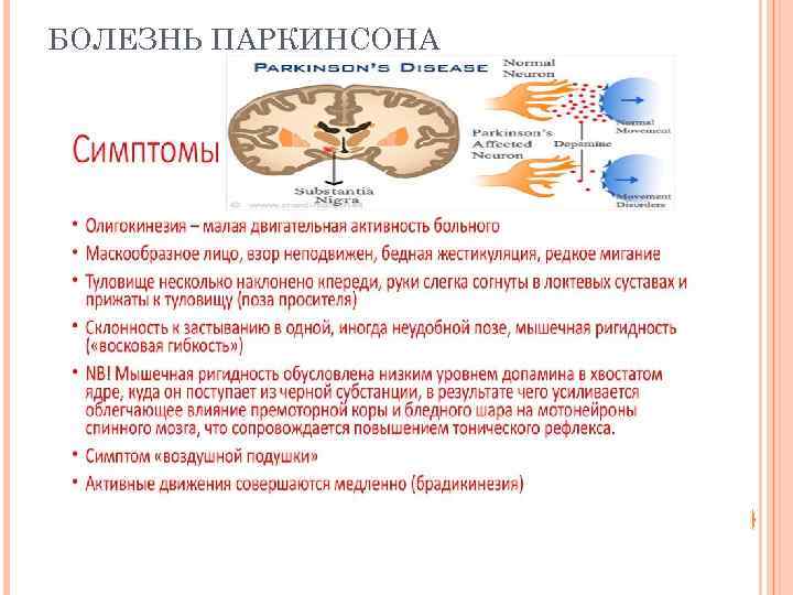 БОЛЕЗНЬ ПАРКИНСОНА 
