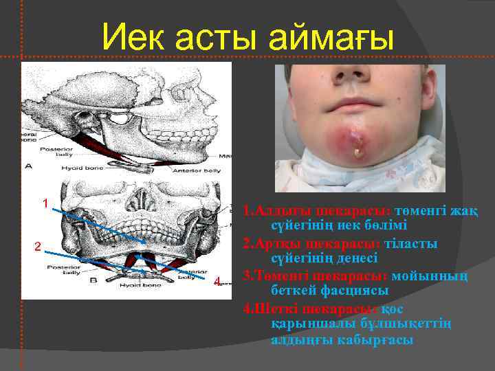 Иек асты аймағы 1 2 4 1. Алдығы шекарасы: төменгі жақ сүйегінің иек бөлімі