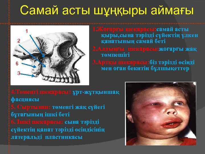 Самай асты шұңқыры аймағы 1 2 2 6 3 1. Жоғарғы шекарасы: самай асты