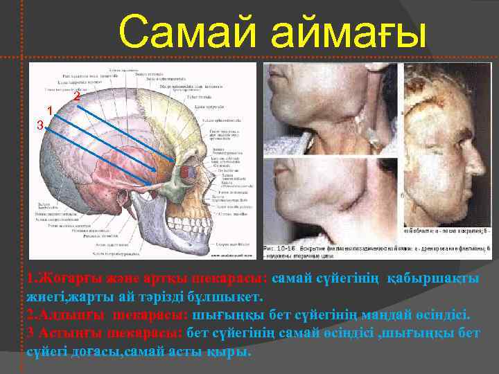 Самай аймағы 2 1 3 1. Жоғарғы және артқы шекарасы: самай сүйегінің қабыршақты жиегі,