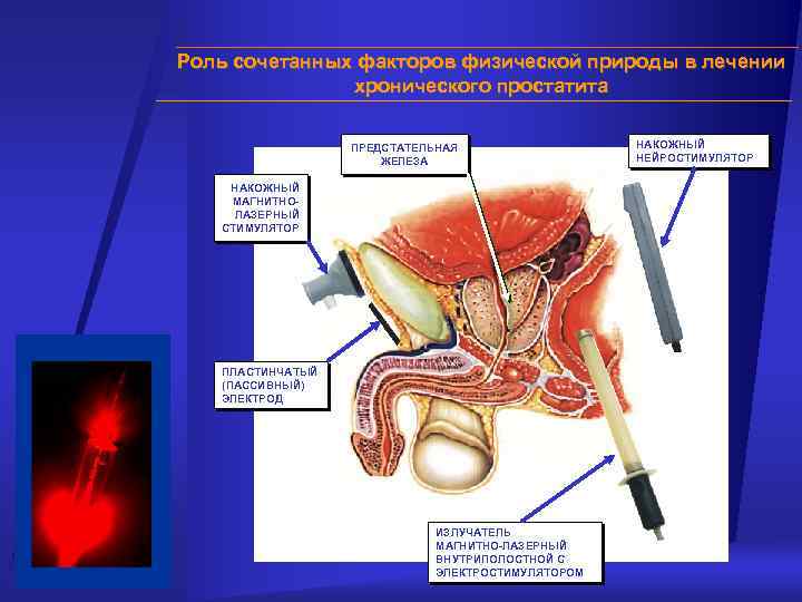 Роль сочетанных факторов физической природы в лечении хронического простатита ПРЕДСТАТЕЛЬНАЯ ЖЕЛЕЗА НАКОЖНЫЙ МАГНИТНОЛАЗЕРНЫЙ СТИМУЛЯТОР