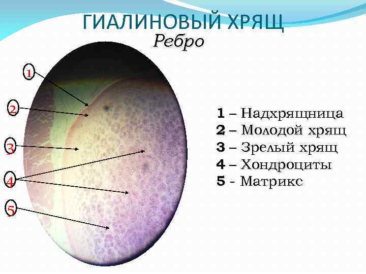 ГИАЛИНОВЫЙ ХРЯЩ Ребро 1 2 3 4 5 1 – Надхрящница 2 – Молодой