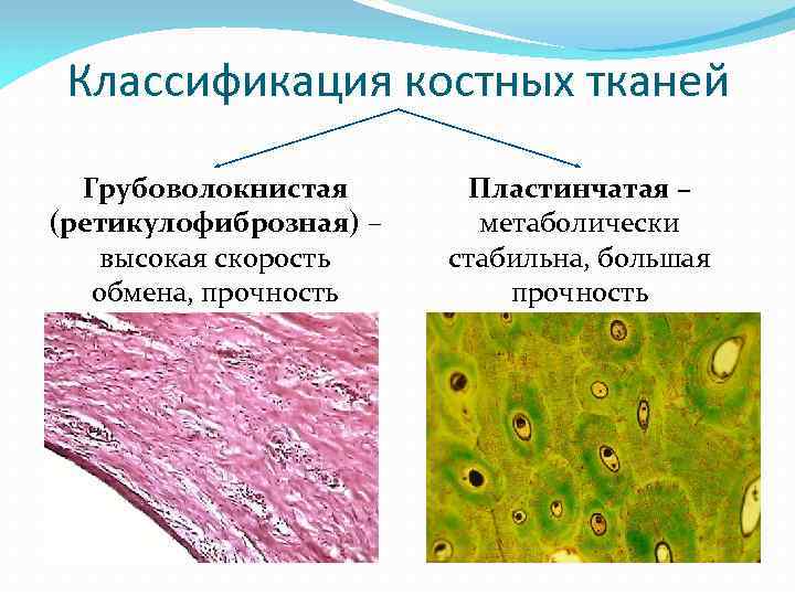 электронный альбом по дисциплине цитология эмбриология гистология работа. . . классификация костных тканей грубоволокнис