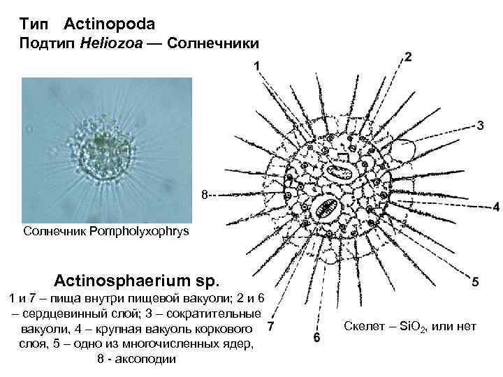 Тип Actinopoda Подтип Heliozoa — Солнечники 8 -Солнечник Pompholyxophrys Actinosphaerium sp. 1 и 7